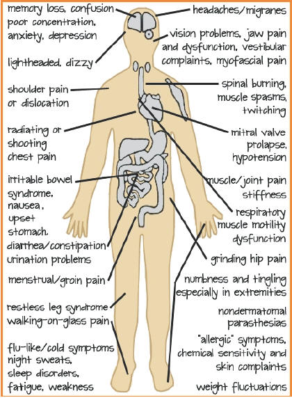 Fibromyalgia Symptoms List Chart